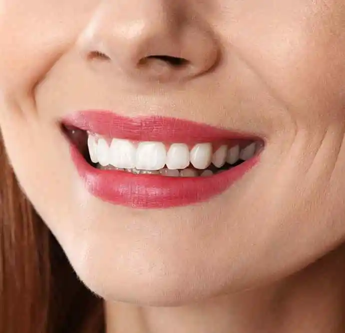teeth after tooth whitening