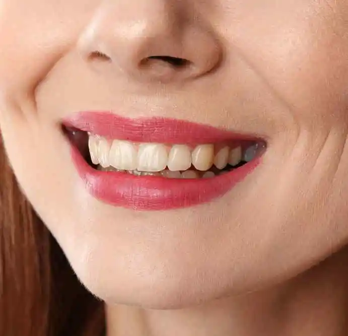 Teeth before whitening paste